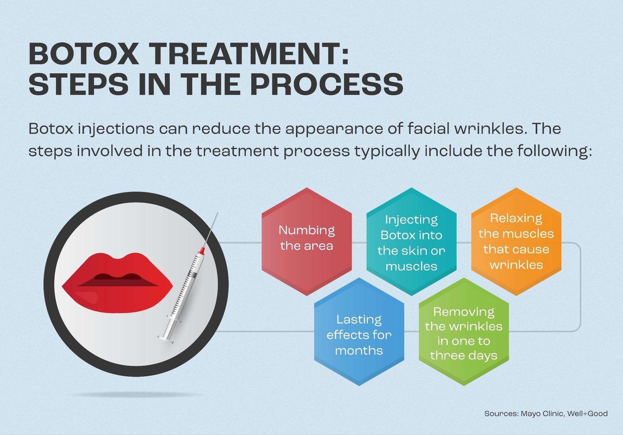 The steps of Botox treatment.